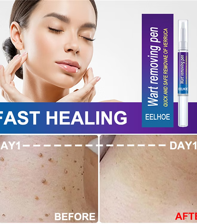 Advanced Herbal Wart Skin Tags Remover