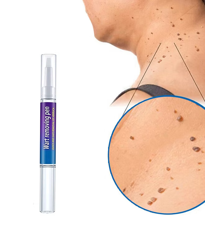 Advanced Herbal Wart Skin Tags Remover