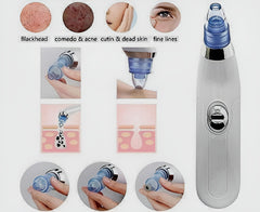 Derma Suction Blackhead Remover Vacuum Suck The Yuck Out Of Your Pores (cell Operated )